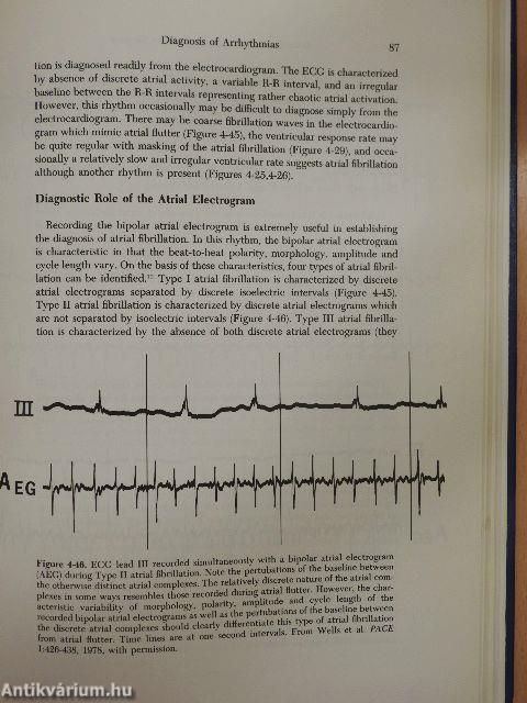 Diagnosis and Treatment of Cardiac Arrhythmias Following Open Heart Surgery