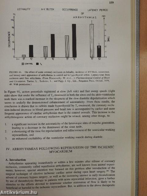 Sudden Death due to Acute Myocardial Infarction