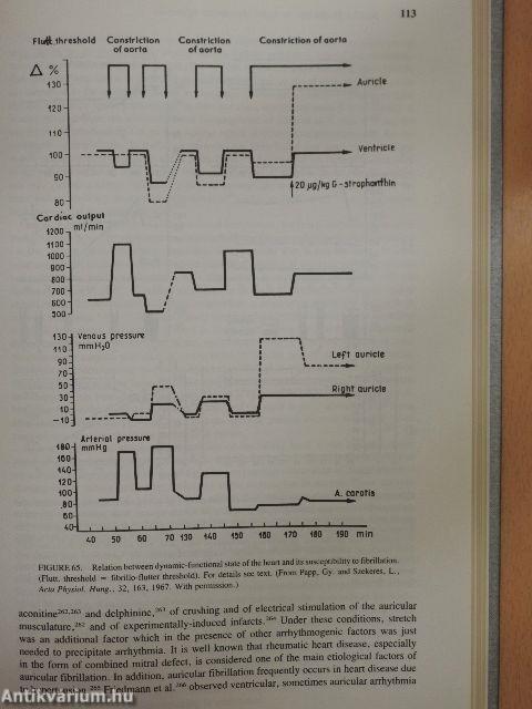 Sudden Death due to Acute Myocardial Infarction