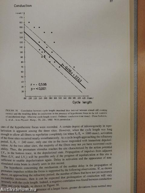 Sudden Death due to Acute Myocardial Infarction