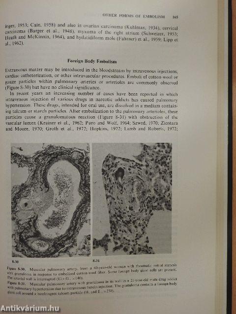 Pathology of Pulmonary Hypertension