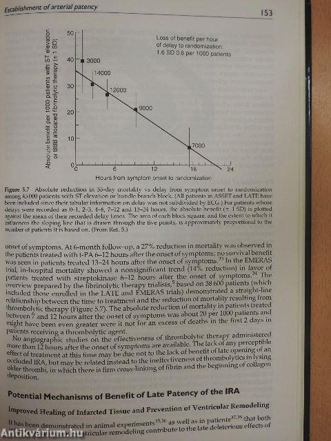 Management of Acute Myocardial Infarction