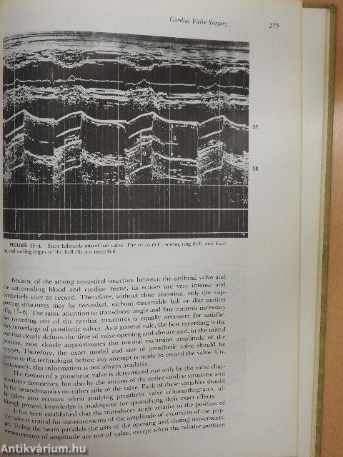 Textbook of Echocardiography