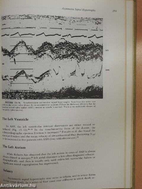 Textbook of Echocardiography