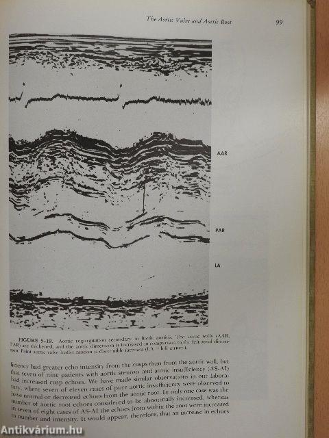 Textbook of Echocardiography