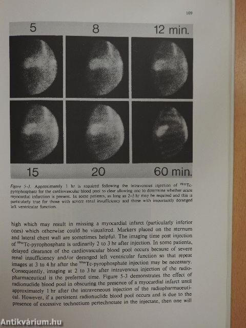 Myocardial Imaging in the Coronary Care Unit