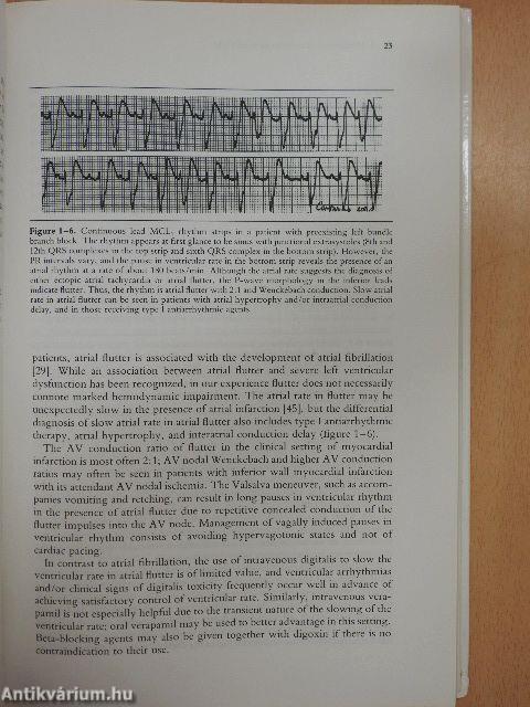 Early Interventions in Acute Myocardial Infarction