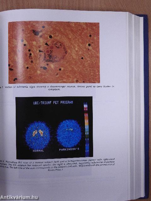 The Metabolic and Molecular Basis of Acquired Disease 1-2