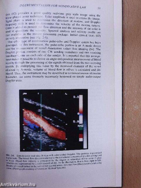 Noninvasive Diagnosis of Peripheral Vascular Disease