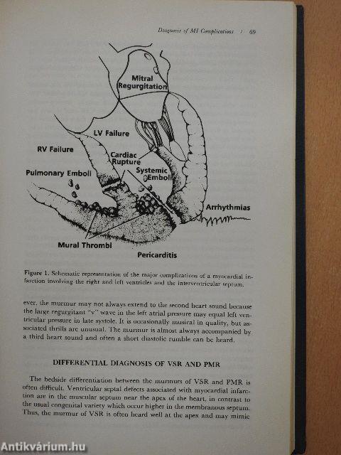 Cardiac Emergencies