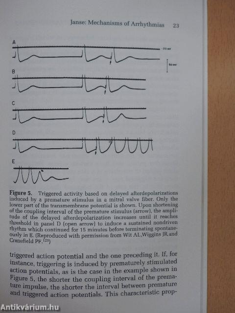 Mechanisms of Arrhythmias