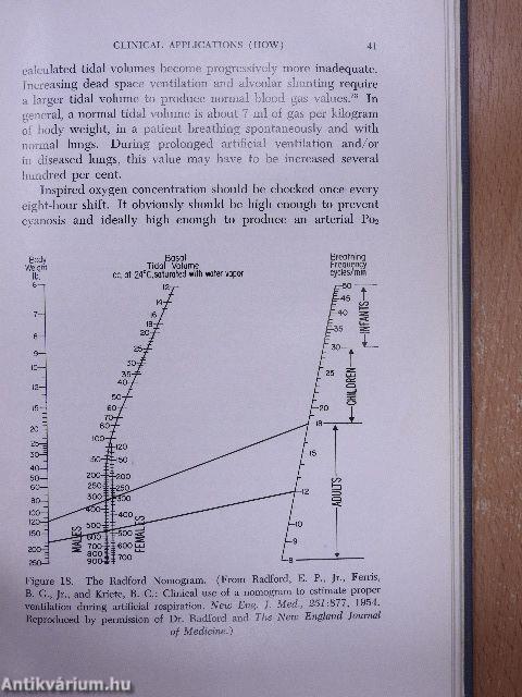 Mechanical Artificial Ventilation