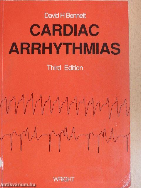 Cardiac Arrhythmias