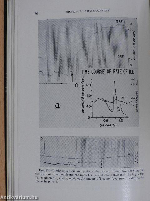 Digital Plethysmography