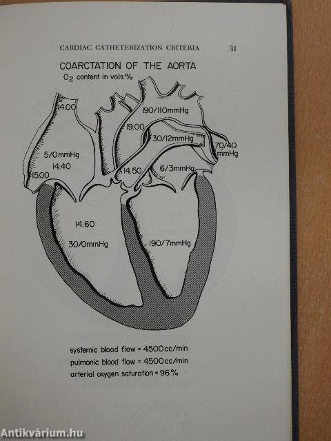 Anesthesia For Surgery of The Heart