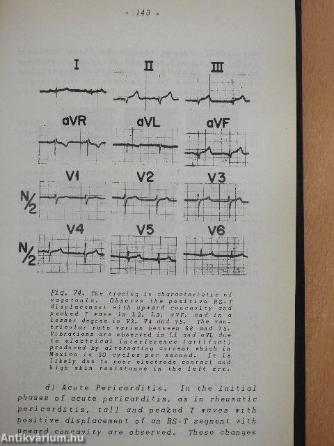 Deductive and Polyparametric Electrocardiography