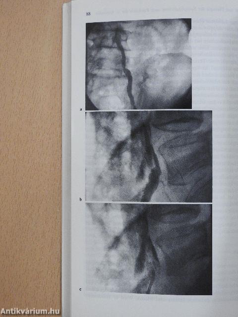 Katheterdiagnostik via Arteria femoralis