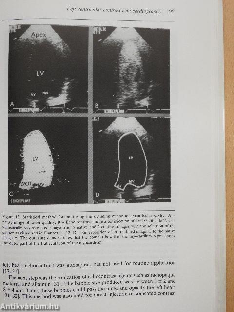Advances in Echo Imaging Using Contrast Enhancement
