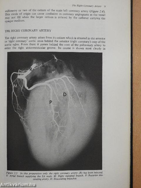 Pathology of Ischaemic Heart Disease