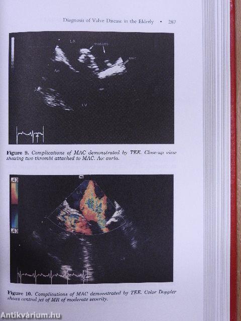 Clinical Cardiology in the Elderly