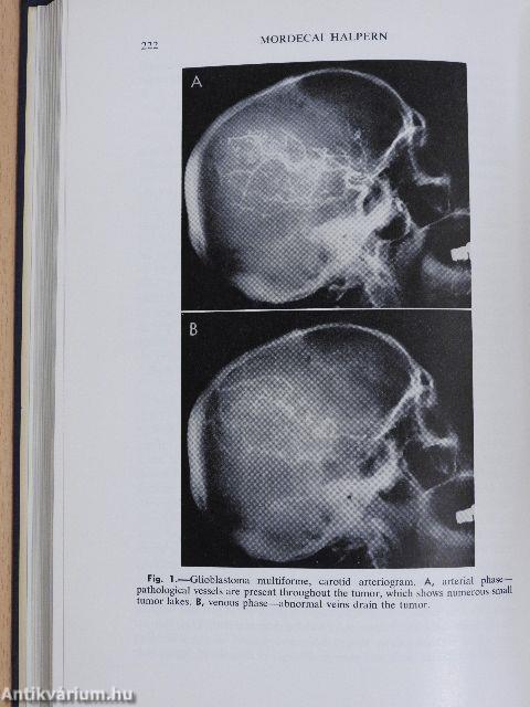 Recent Advances in the Diagnosis of Cancer