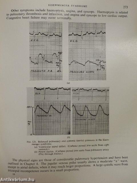 Clinical disorders of the pulmonary circulation