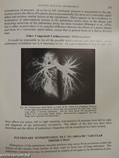 Clinical disorders of the pulmonary circulation