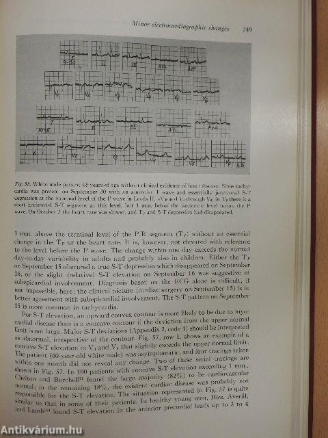 Differentiation between normal and abnormal in Electrocardiography