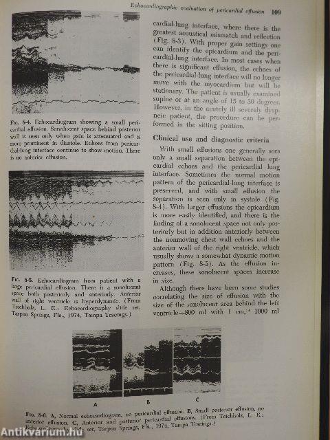 Cardiac Ultrasound