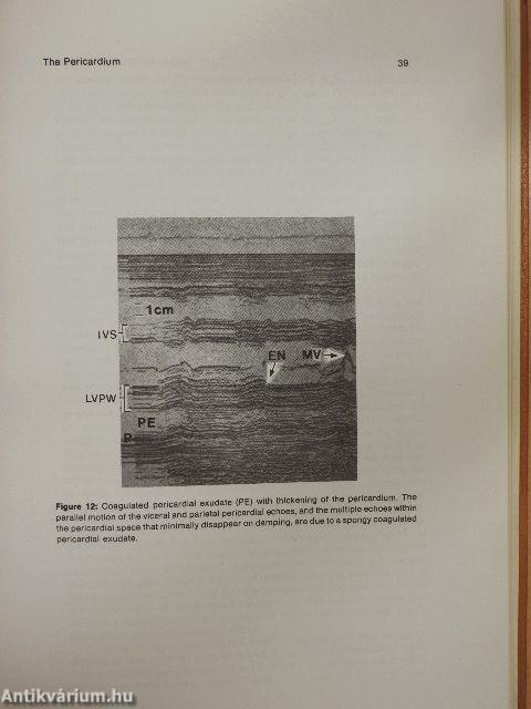 Clinical echocardiography