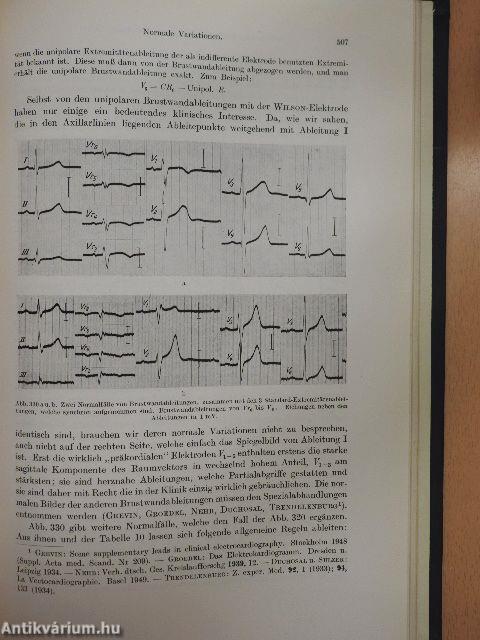 Das elektrokardiogramm theorie und klinik