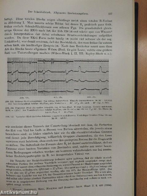 Das elektrokardiogramm theorie und klinik