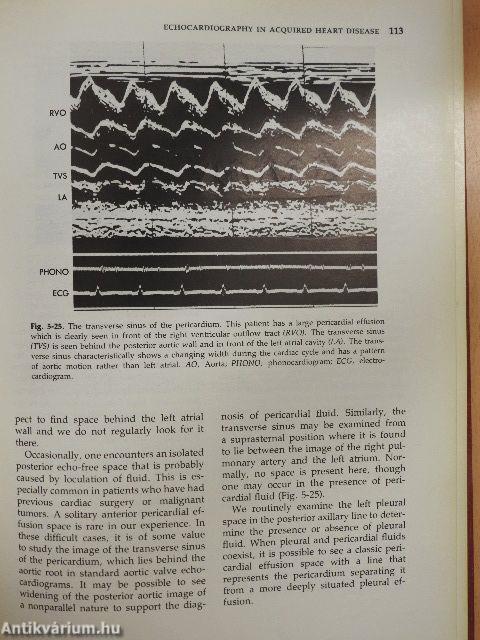 Diagnostic Ultrasound