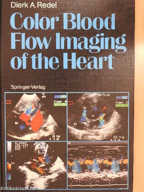 Color Blood Flow Imaging of the Hearth
