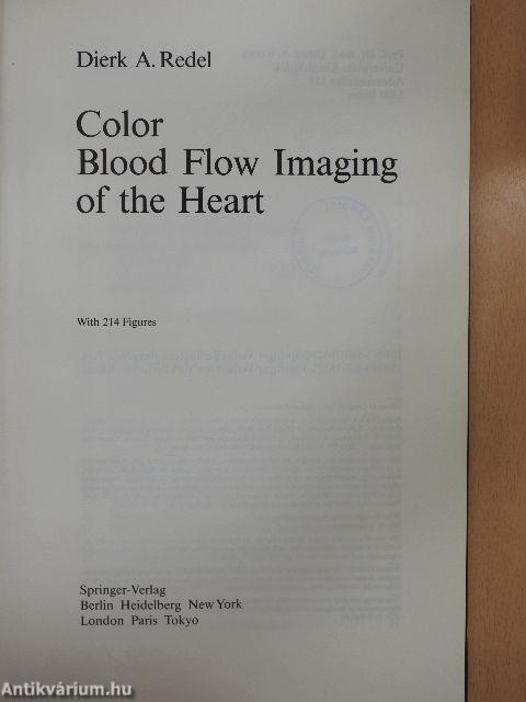 Color Blood Flow Imaging of the Hearth