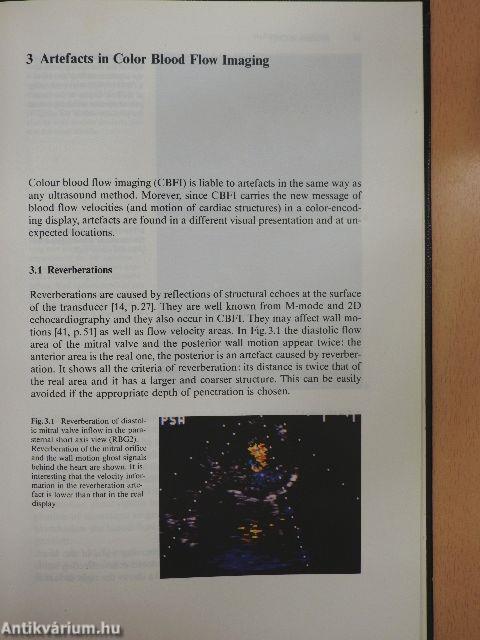 Color Blood Flow Imaging of the Hearth