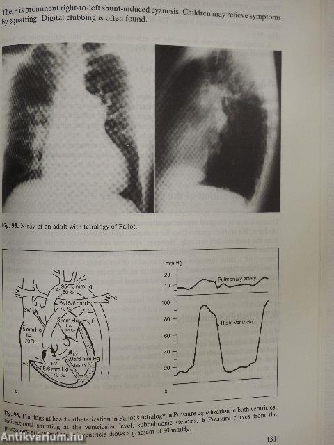 Concise cardiology