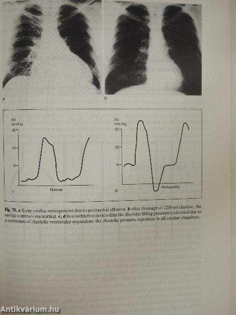 Concise cardiology