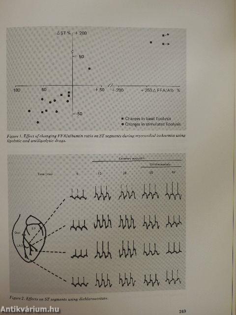 Acute and Long-Term Medical Management of Myocardial Ischaemia