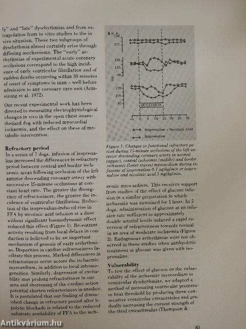 Acute and Long-Term Medical Management of Myocardial Ischaemia