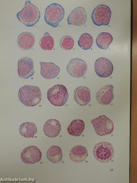 Atlas der klinischen Hämatologie