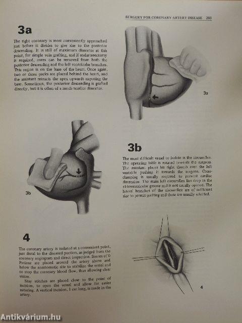 Cardiothoracic surgery