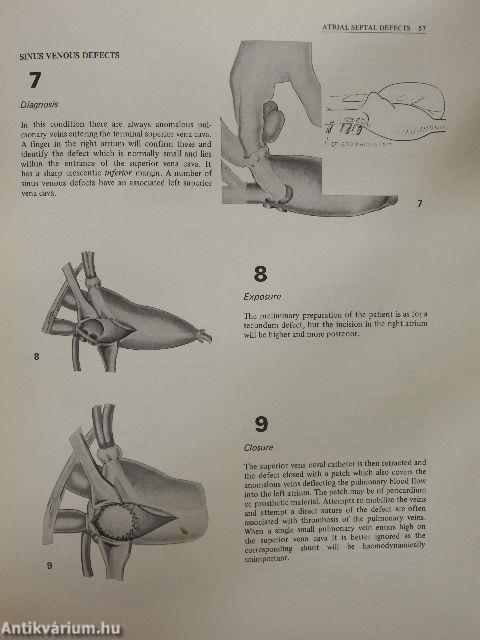 Cardiothoracic surgery