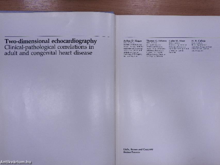 Two-dimensional echocardiography