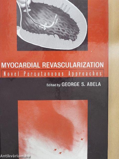 Myocardial revascularization