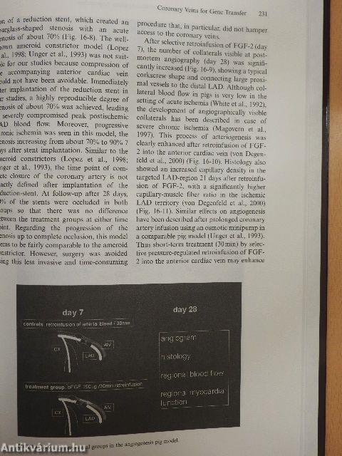 Myocardial revascularization