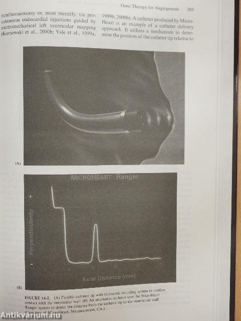 Myocardial revascularization