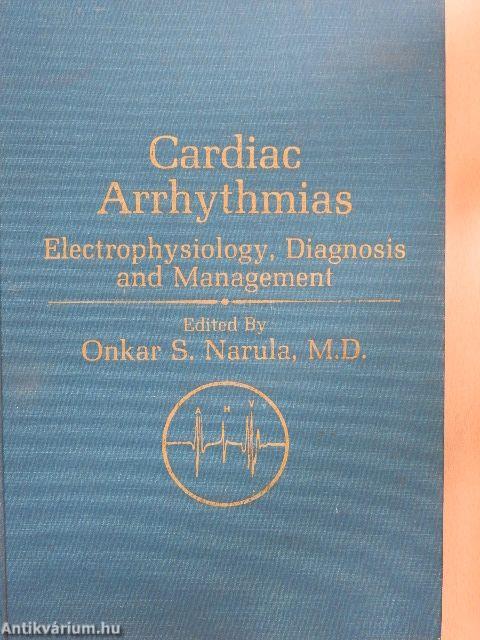 Cardiac Arrhythmias