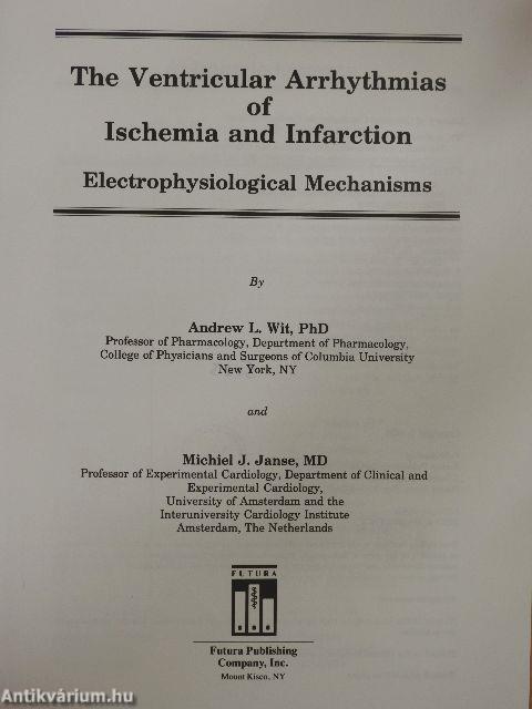 The Ventricular Arrhythmias of Ischemia and Infarction