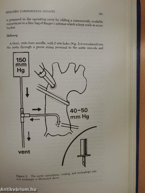 A textbook of clinical cardioplegia